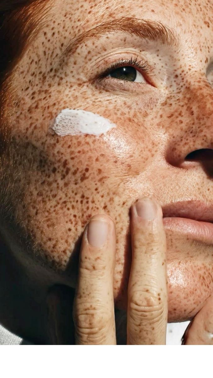 Cream on freckled skin