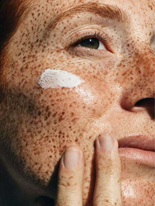 Cream on freckled skin